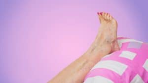 Senior-Woman-Swollen-Ankles
